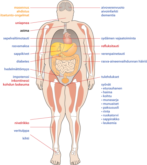 Lihavuuteen liittyvviä sairauksia